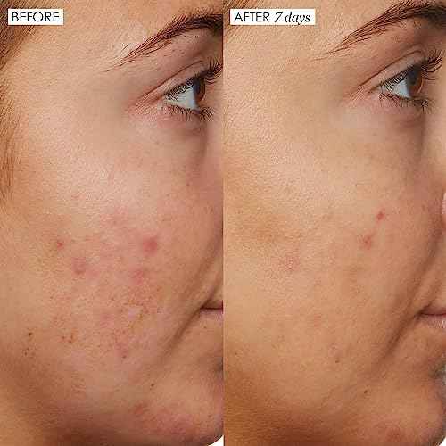 Sunday Riley B3 Nice 10% Niacinamide Serum 1.0oz