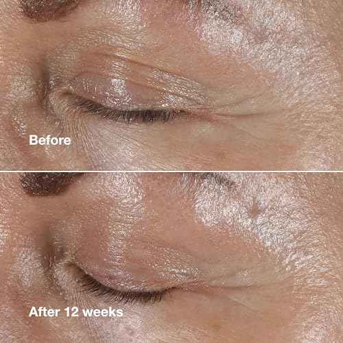 Clinique Smart Clinical Repair Wrinkle Correcting Eye Cream With Hyaluronic Acid + Peptides | Anti-Aging, Hydrating + Depuffing