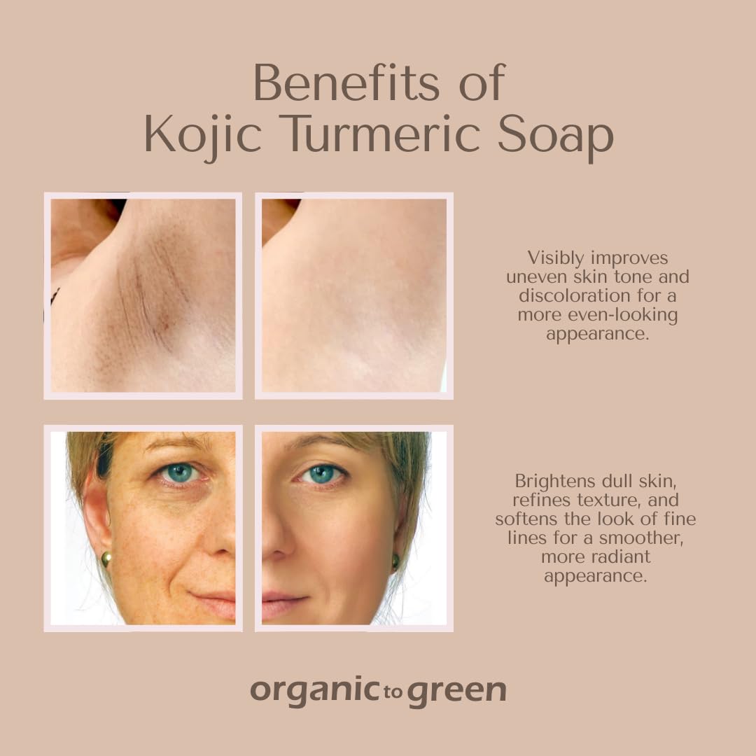Organic To Green Kojic Turmeric Soap for Dark Spots - Infused with Hyaluronic Acid, Retinol, Vitamin E, Shea Butter, Collagen (3 Pack - Lemon, Fresh Ginger, and Lavender Scent)
