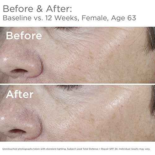 SkinMedica Total Defense + Repair SPF 34 Sunscreen for Face. This Lightweight, Facial Sunscreen is Ideal for Oily and/or Combination Skin, 2.3 Oz