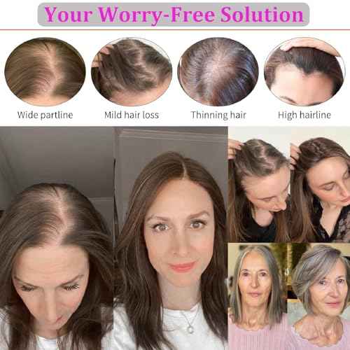 Hair Toppers for Women Real Human Hair, 4x4.8 Inch Upgrade Basement 360¡Æ Cover 3D Clip in Hairpieces for Women with Thinning hair, 14 Inch 2# Dark Brown