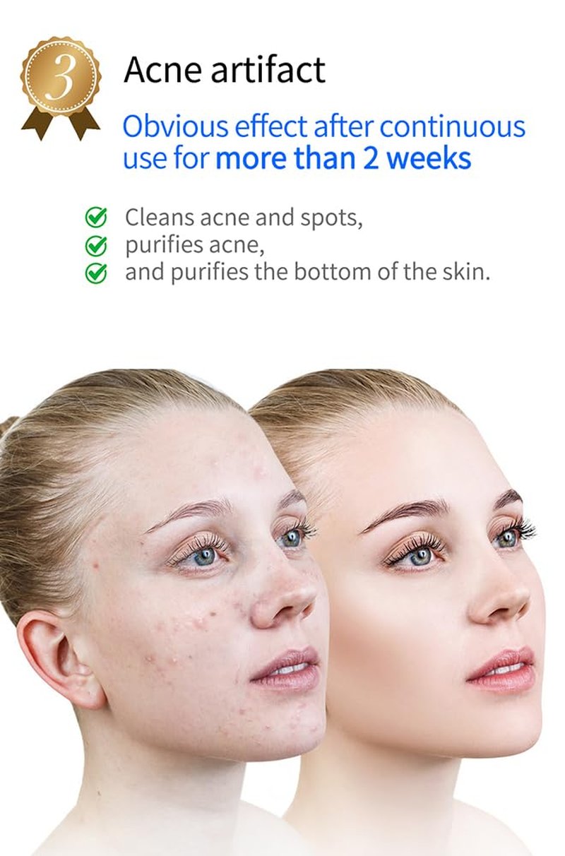 KinseiBeauty Plasma Facial Device, Ozone Skin Care Machine, Face Massager for Acne Treatment, Brightening, Anti-Wrinkle