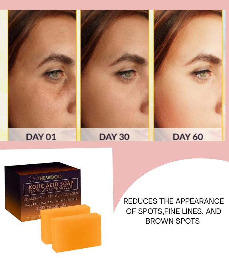 Kojic Acid Dark Spot Remover Soap Bars with Vitamin C, Retinol, Turmeric - Original Japanese Complex Infused with Hyaluronic Acid, Vitamin E, Shea Butter, Castile Olive Oil (2 Pack)
