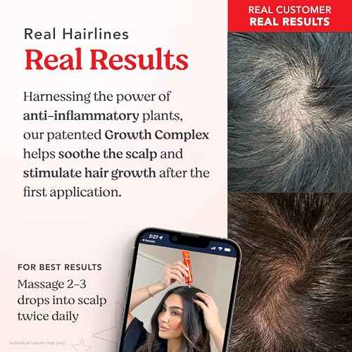 HAIRtamin Scalp Serum | Visibly Thicker, Nourished Hair and Healthy Scalp Treatment (Two Pack)