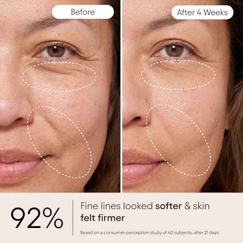 Alpyn Super Peptide & Ghostberry Moisturizer for Eczema, Barrier & Wrinkle Repair | Calm & Soothe Against Redness & Irritation | 1.7 oz / 50 ml
