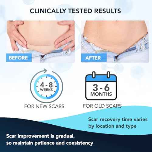 Silicone Scar Gel: Silicone Gel for Scars - Improve Scar Appearance for Old and New Scars - Medical Grade Silicone - Advanced Scar Gel - Scalds - Surgery - Injury - Stitches - Burns - 20g