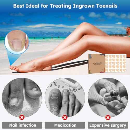 Ingrown Toenail Treatment, No Glue Breathable Curved Toenail Corrector£¬Ingrown Toenail Corrector Strips with File and Lifter, Professional Nail Correction Stickers 60Pcs
