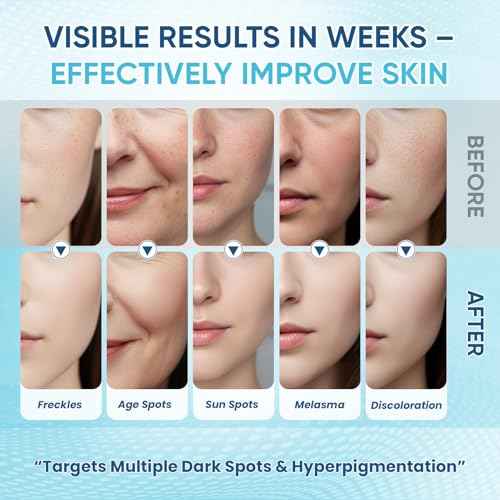 Dark Spot Remover for Face Body Serum with Hyperpigmentation Treatment Skin Brown Spot Age Spot Remover Dark Spot Corrector Glow Serum Brighten Even Gentle and Non-Irritating Unisex 1 Fl Oz 2 pack