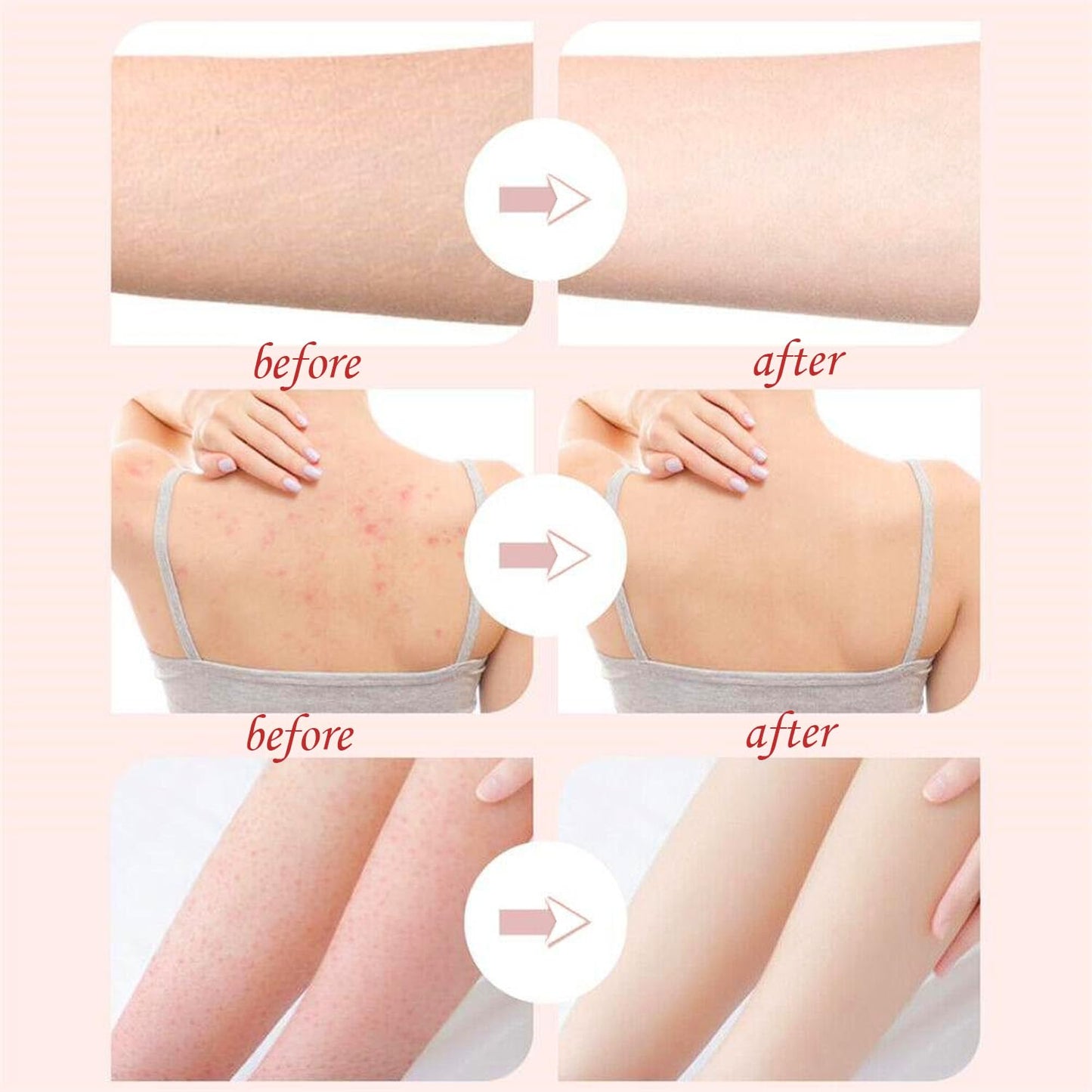 Super Soft Sunflower Suction Cup Bath Ball, New Upgraded 2-in-1 Sunflower Ball Exfoliating Loofah Sponge Mesh Pouf Shower Ball with Comfortable Non-Slip Handle (Yellow)