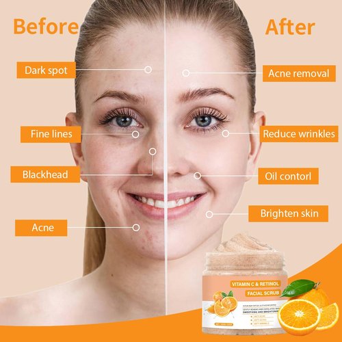 Vitamin C Face Scrub, Exfoliating Facial Wash with Retinol, Facial Scrub,Facial Exfoliating Scrub, Facial Scrubs for Women,Deep Cleansing Face Wash Cleanser for Women Men