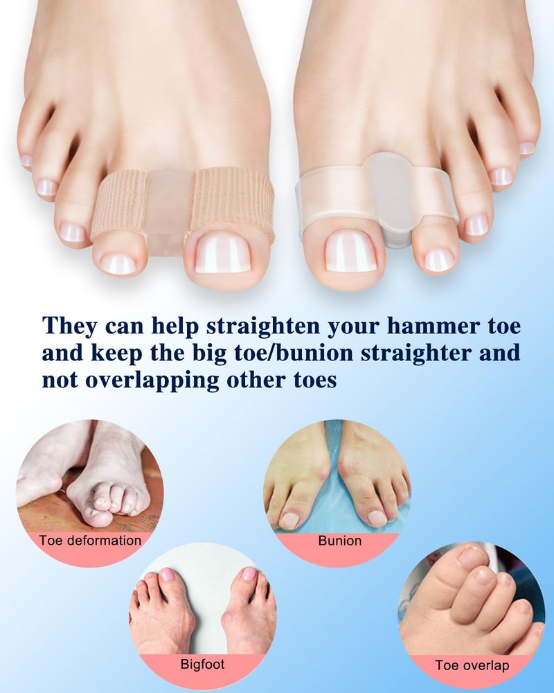PGRODE 8PC Bunion Toe Separators Gel Bunion Corrector Soft Big Toe Spacers for Feet Women Men Toe Correct, Elasticity Hammer Toe Straightener with 2 Loops (4 Nylon+4Gel)