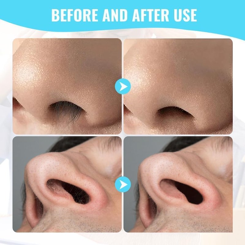 Mqacpu Upgraded Nasal Hair Cutter for Women Men, 2026 Travel Portable Manual Double Sided Nose Hair Cutter, 2 in 1 Nose Hair Remover 360° Rotating Nasal Grooming Tool (Blue, 3pcs)