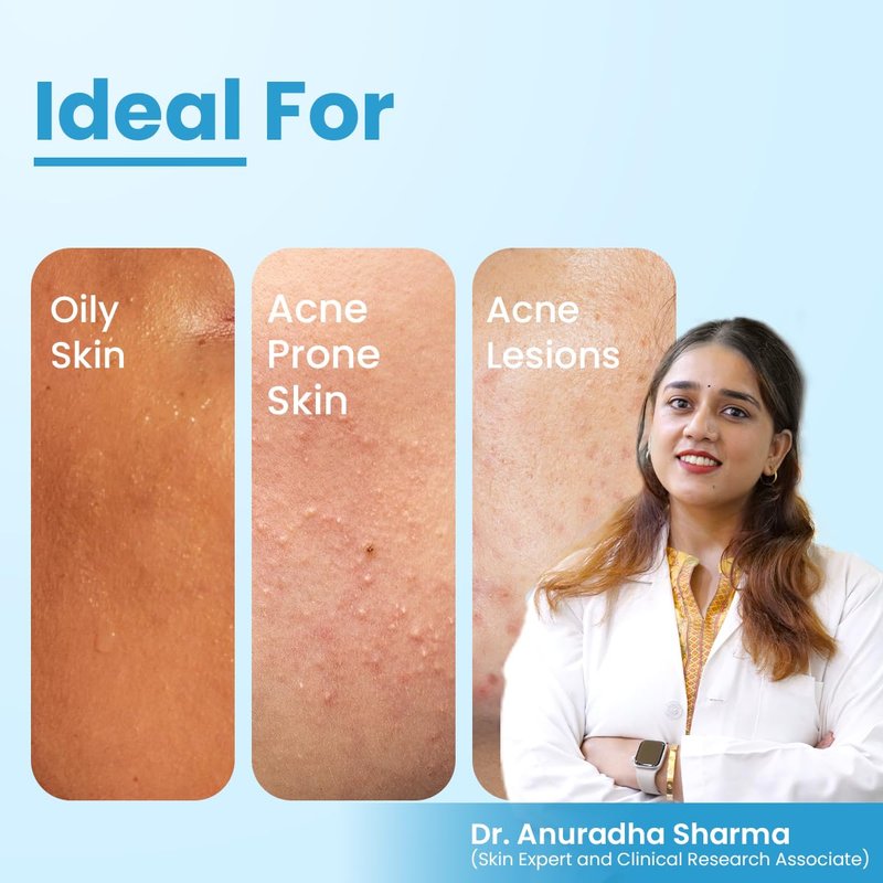 FCL 2% Benzoyl Peroxide Face Wash, B-Prox 10 Face Wash for Acne Exfoliate Blackheads Controls Oil Production, Soap free Non-Drying, Non-comedogenic Cleanser - 3.38 FL Oz