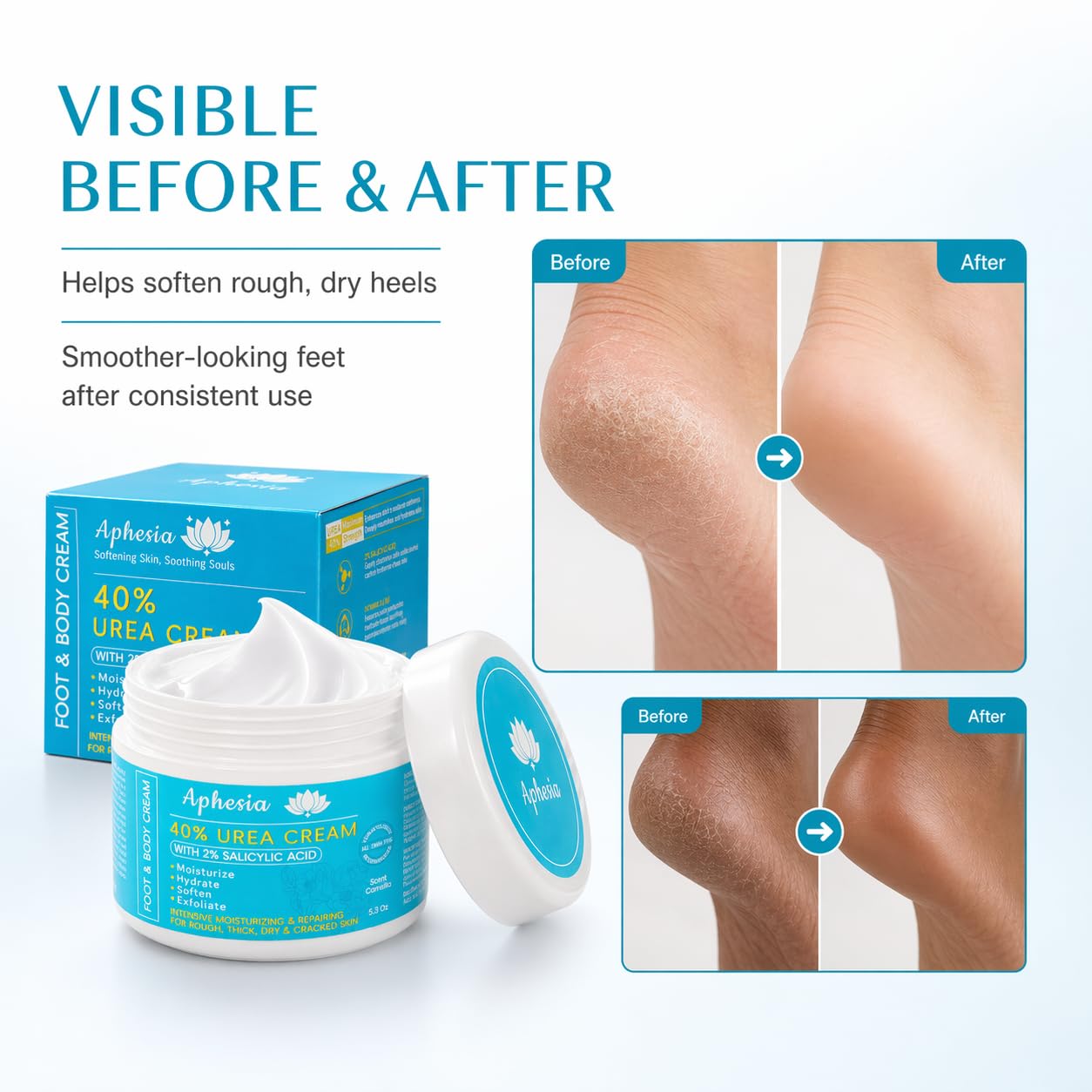 Urea Cream 40 Percent for Feet Maximum Strength w/ Vitamin E & 2% Salicylic Acid, Non-Greasy Formula Foot Cream for Summer Dry Cracked Heels - Intense Moisturizer Callus Remover for Hands, Foot, Body