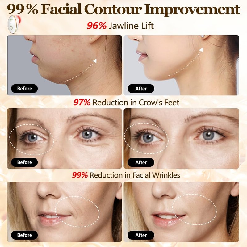 Facial Cupping Set for Face, 3 in 1 Microcurrent Facial Device, 7 Color LED Lymphatic Drainage Massager for Face Skin Tightening & Depuffing, Double Chin Reducer