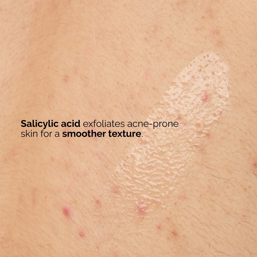 The Ordinary Salicylic Acid 0.5% Body Serum - Exfoliating Treatment for Acne-Prone Skin | 8.1 Fl Oz