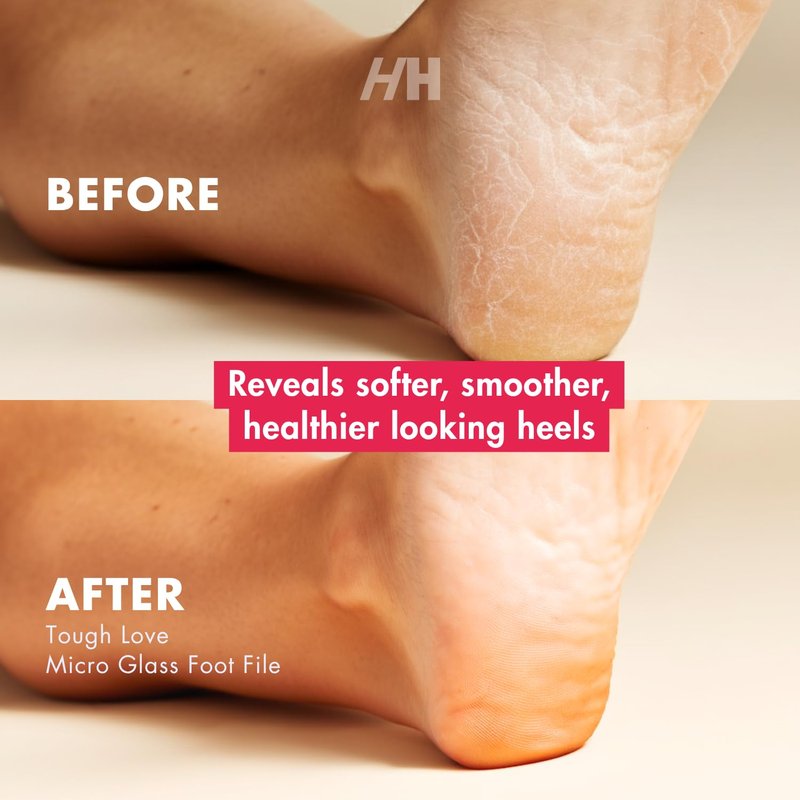 Handmade Heroes Exfoliating Foot Scrub – Smooths Dry, Rough Feet & Cracked Heels – Gentle Callus Care for Silky Soft Soles