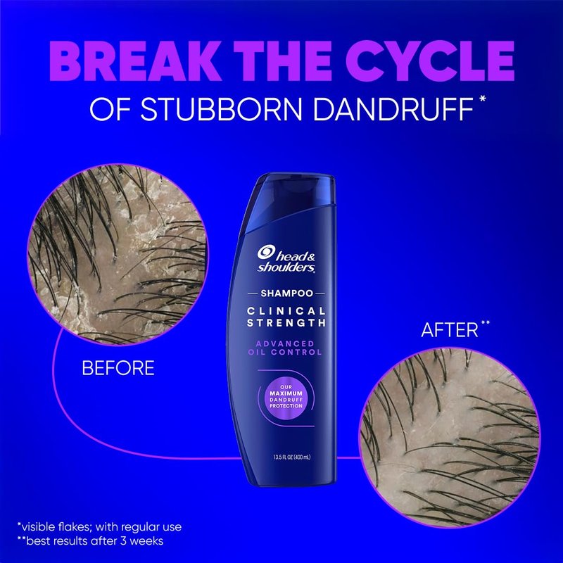 Head & Shoulders Dandruff Shampoo, Clinical Strength Advanced Oil Control, Our Maximum Anti-Dandruff Prescription-Strength Formula, Flake Protection, Seborrheic Dermatitis Relief, Citrus, 13.5 Fl Oz