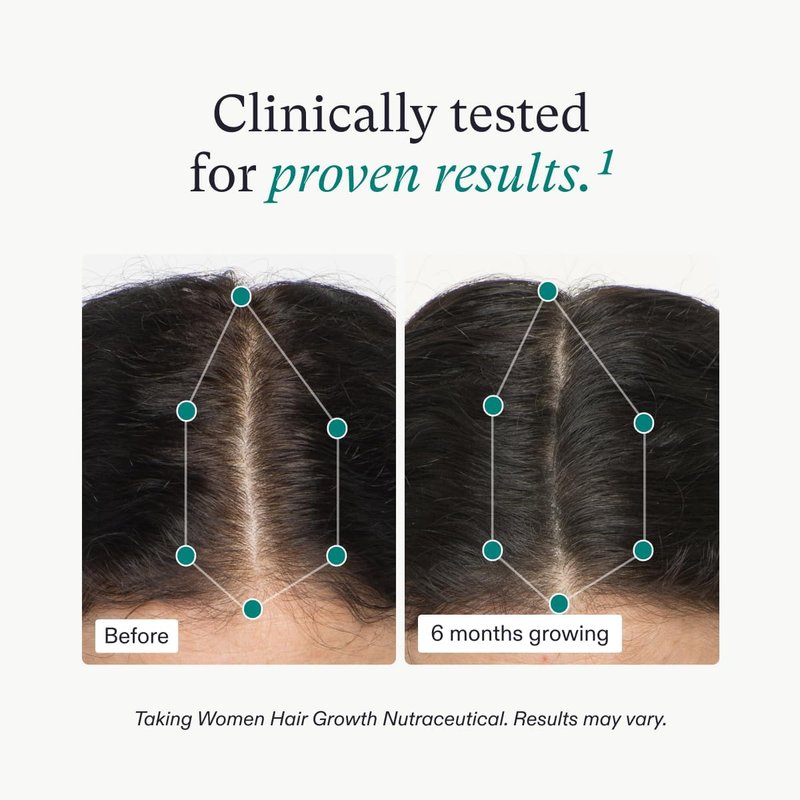 Nutrafol Women's Hair Growth Supplement and Collagen Peptides Powder, Ages 18-44, Physician-formulated for Visibly Thicker, Stronger Hair, Dermatologist Recommended - 1 Month Supply, 12 oz Bottle
