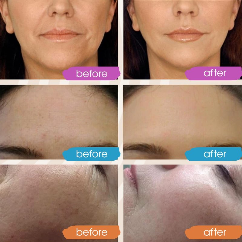 GLEOW Retinol Serum for Face, Vitamin C with Hyaluronic Acid Face Serum for Women and Men, Glow Skin Care Set Total Package Targets Appearance of Uneven Skin Tone and Dryness 3x1oz