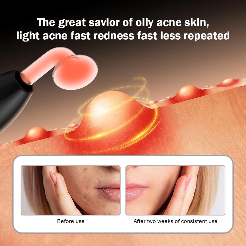 Lucsuer OxyGlow2 Cordless High Frequency Facial Machine - ProFacial Wand Clinical Skin Therapy Wand - Neon+Argon Gas (Onyx Black)