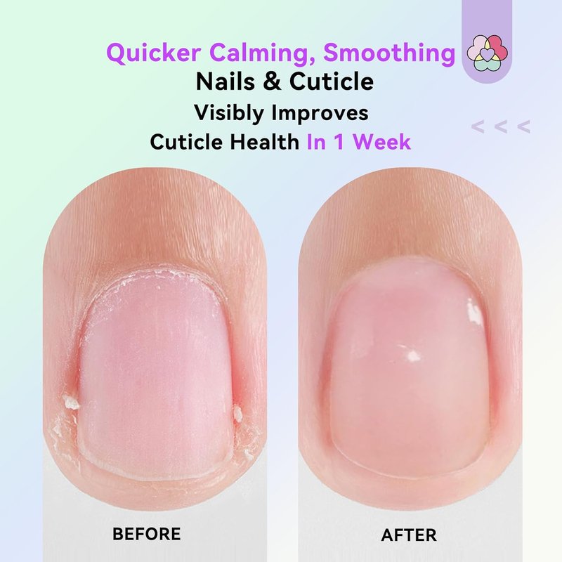 SAVILAND Cuticle Oil Pen - 6Pcs Plant-Based Nail Strengthener with Aloe & Vitamin E for Moisturizing & Repairing