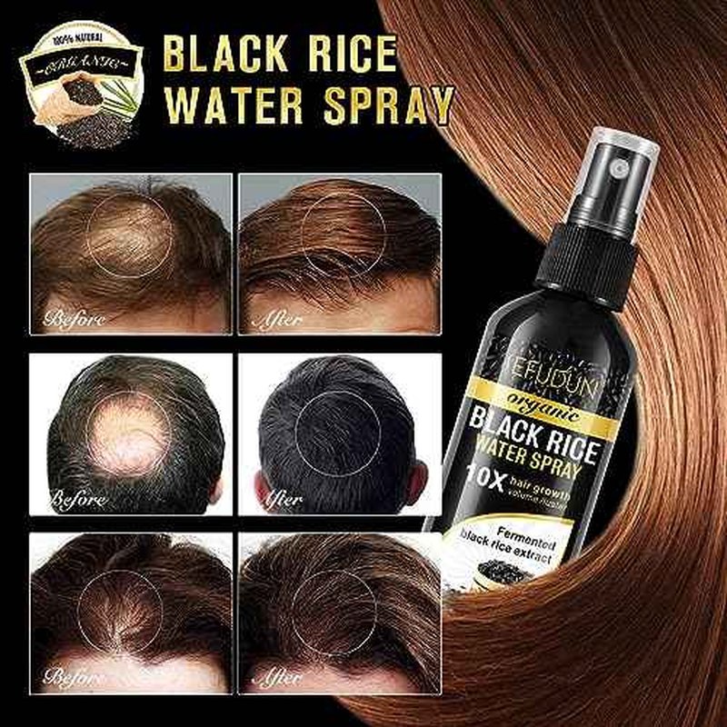 (3Pc) Organic Black Rice Water Spray for Hair Growth, A Solution with Castor Oil & Ginger Root Extract for Thicker, Fuller Hair, Targets Hair Loss and Repairs Damage 300ml/9.6 fl.oz