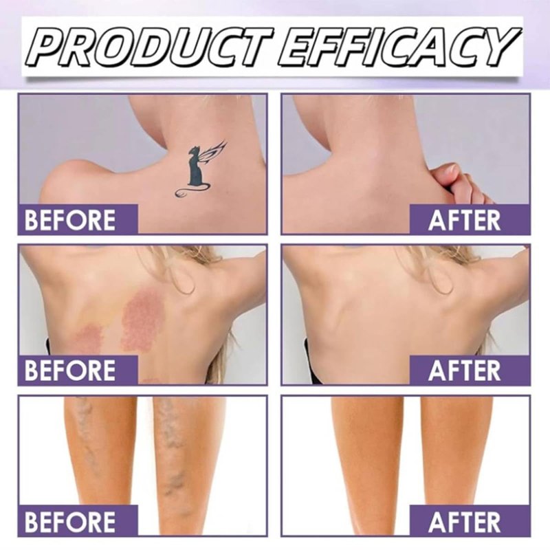 Body Coverage Perfector, Waterproof Sweatproof Body Makeup with Brush, Long Lasting Body Foundation for All Skin Tones (Medium)