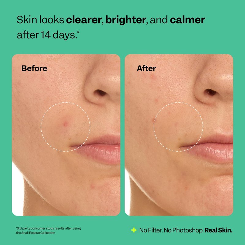 Peach Slices Snail Rescue Cleanser - Purifying Formula with Snail Mucin & Hyaluronic Acid (4.05 oz) | Refresh & Cleanse Skin