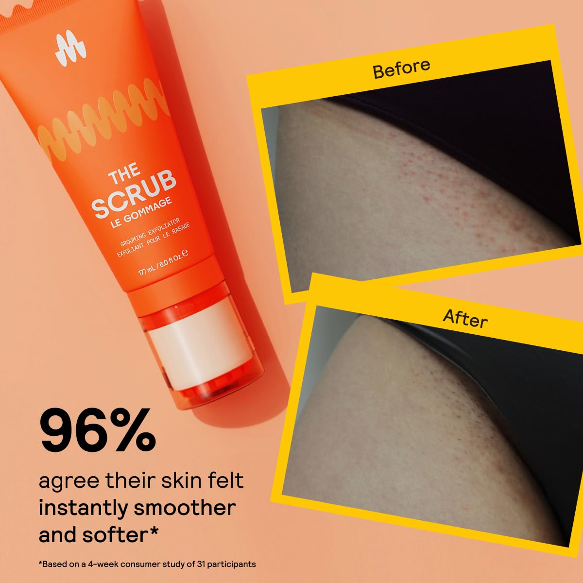 Meridian Pre-Grooming Exfoliator Scrub + Hydrating Gel for Intimate Areas & Sensitive Skin, Ideal for Pubic, Bikini & Armpit Areas, Reduce Skin Irritation, Ingrown Hairs & Bumps