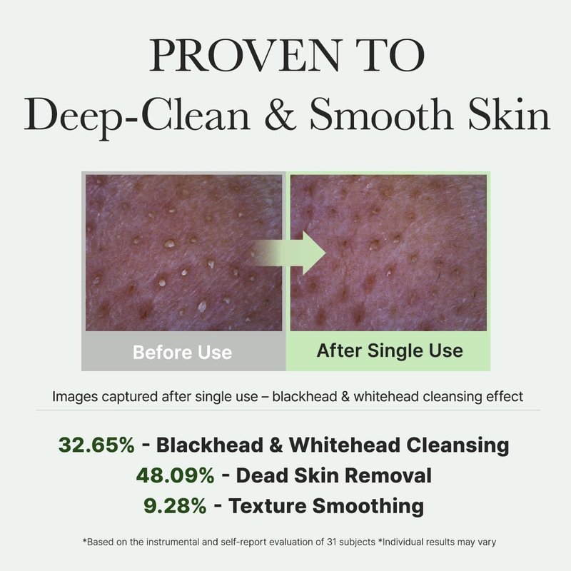 Arencia Korean Rice Mochi Face Cleanser - Gentle All-in-One Face Wash for Deep Cleansing & Moisturizing | Acne-Prone Skin, 150ml