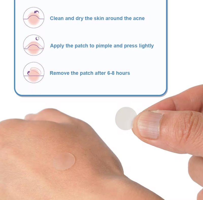 Acne Pimple Patches (144 Count) – Hydrocolloid Acne Patches for Face, Invisible & Waterproof, Fast Absorbing Zit Stickers for Pimples, Blemishes & Whiteheads – Day & Night Treatment