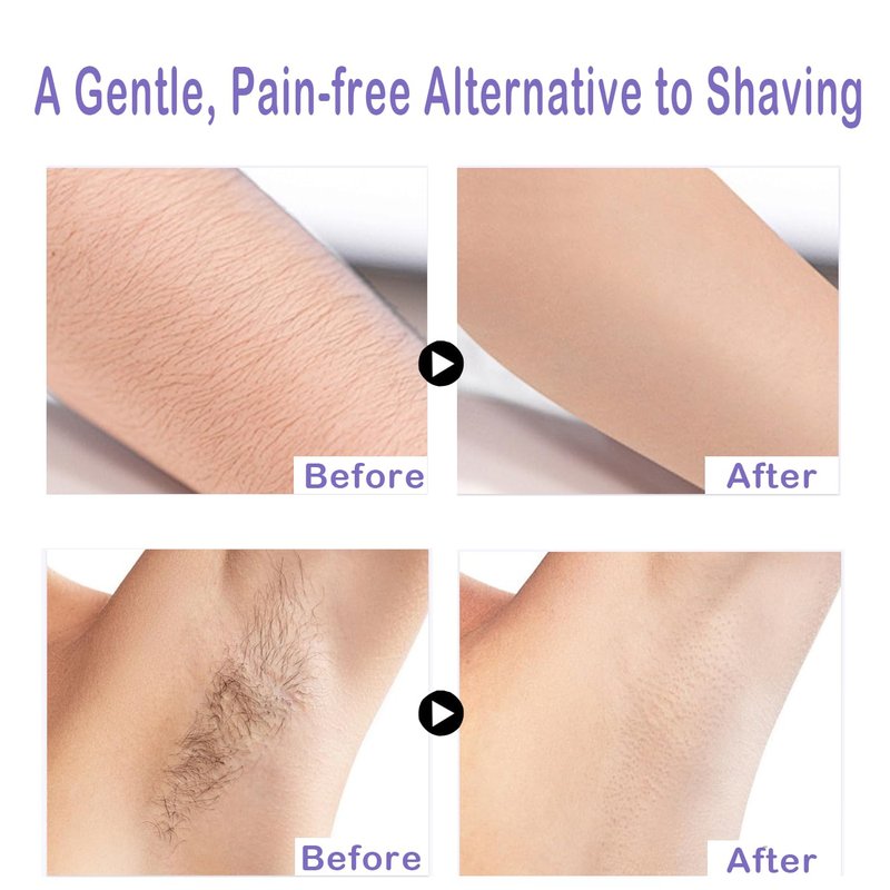 Body Hair Removal Cream - Painless Depilatory Cream for Legs, Arms, Underarms & Bikini Line | Gentle Formula