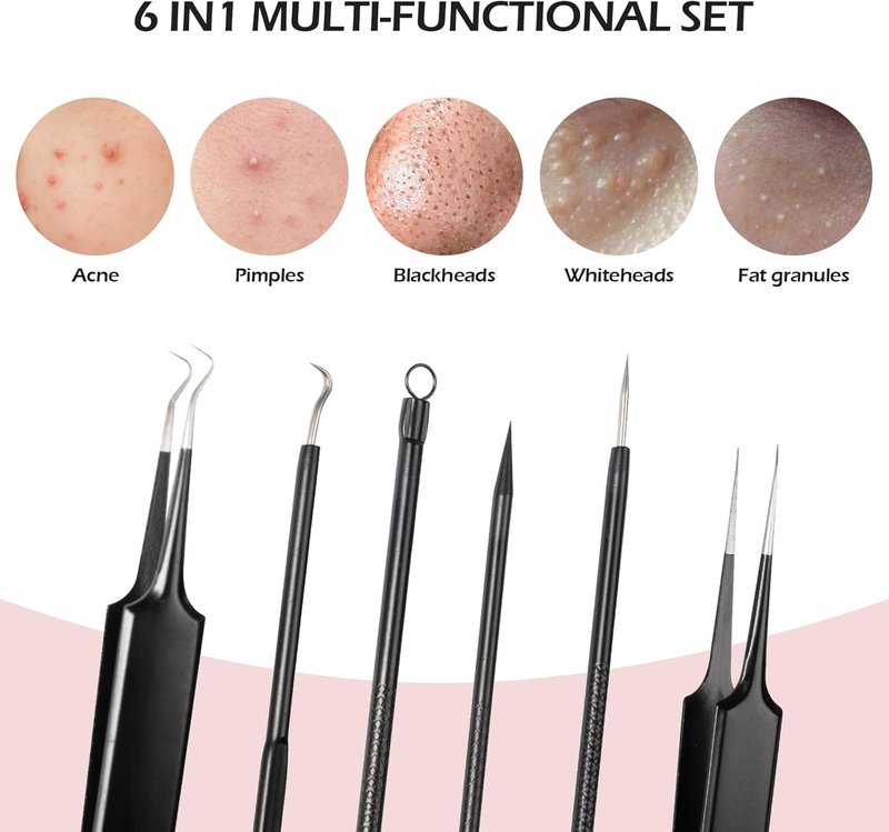 Skiennix Blackhead Remover Tool Kit - 6-Piece Pimple Popper Set for Clear Skin | Black