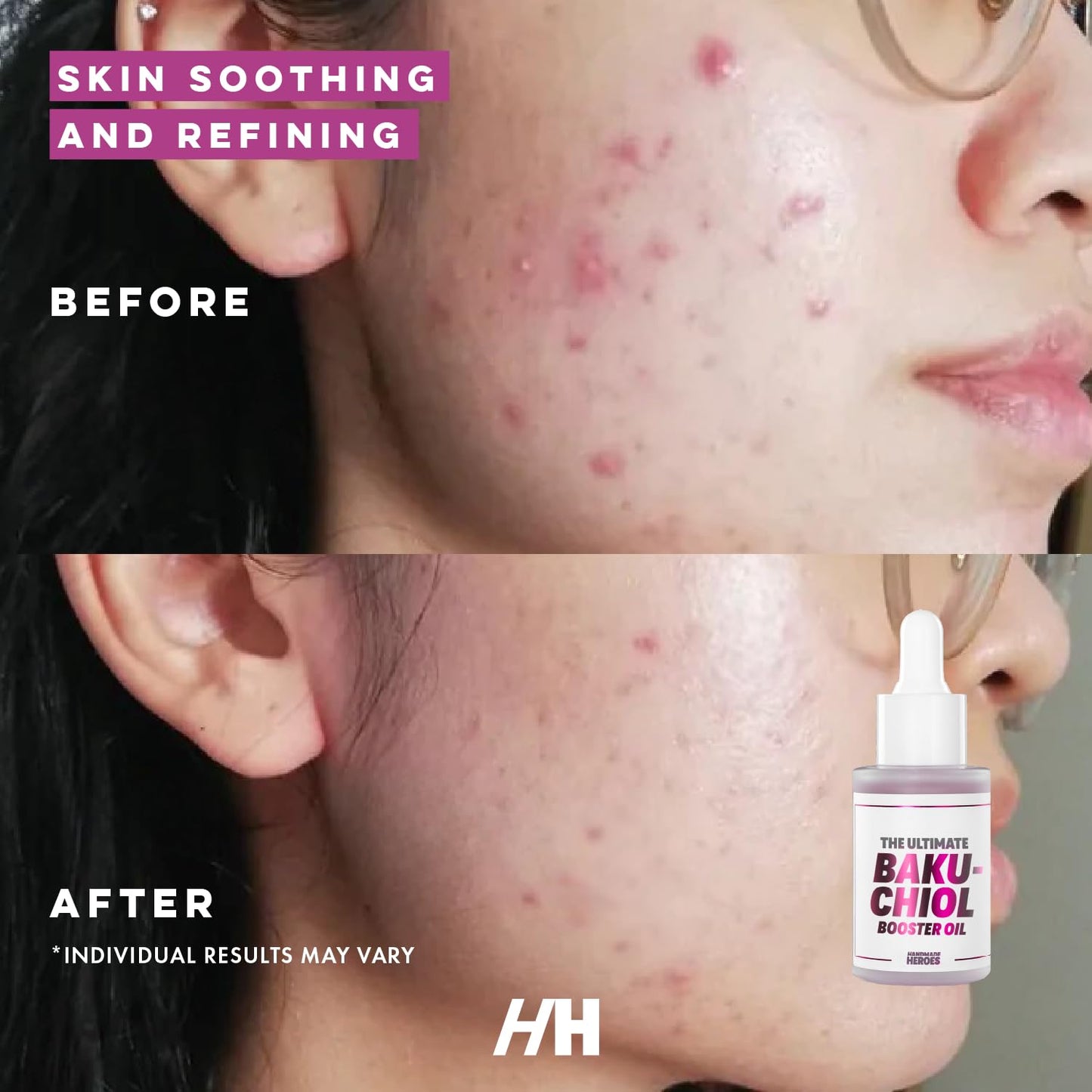 Handmade Heroes 2% Bakuchiol Oil Lifting and Firming Oil for Guasha Neck, and Décolleté, All Natural Retinol Alternative For Radiant and Line Smoothing 0.75oz