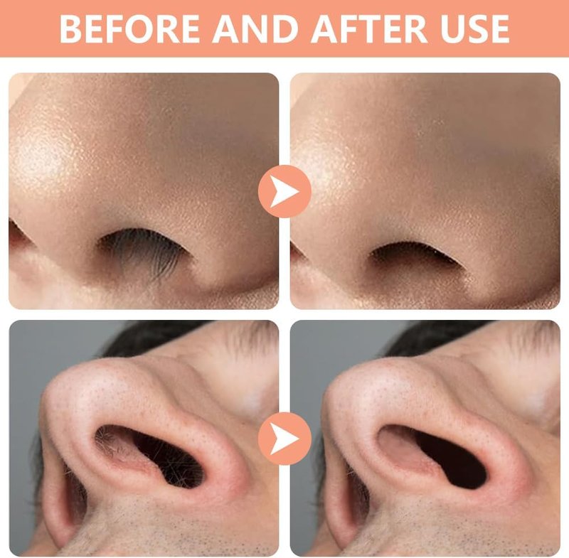 2-in-1 Nose Hair Cutter & Ear Picker - Portable Manual Nasal Trimmer with 360° Rotating Blade for Men & Women | 6-Piece Set