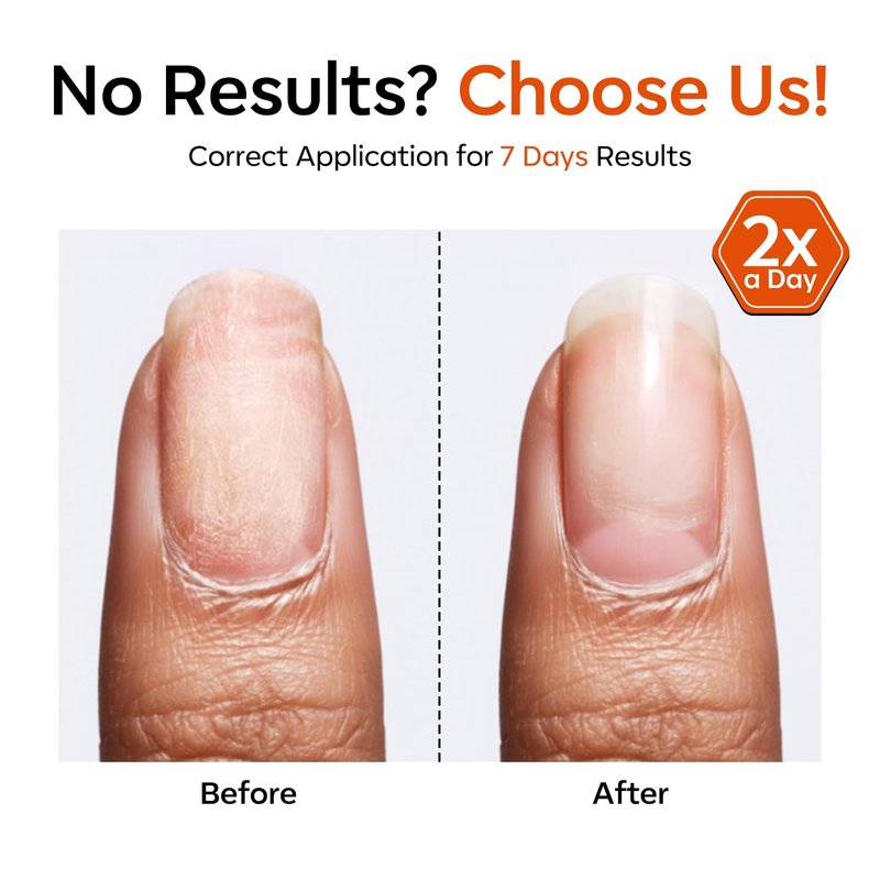 modelones Nail Strengthener and Growth Clear Nail Hardener Extra Strong and Growth 3-in-1 Scented Nails Repair for Damaged Nails Repair Mode Gifts for Women 13.5ml 0.46 Fl Oz