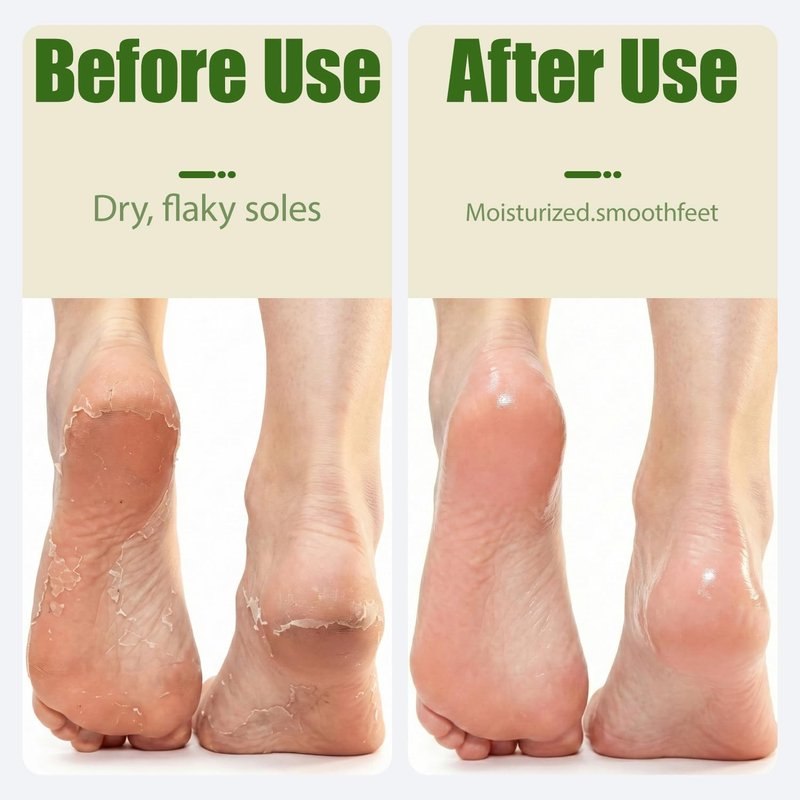Aloe Vera Gel Socks - Deep Hydrating Moisturizing Foot Care | Fits Women 6-10 / Men 5-9
