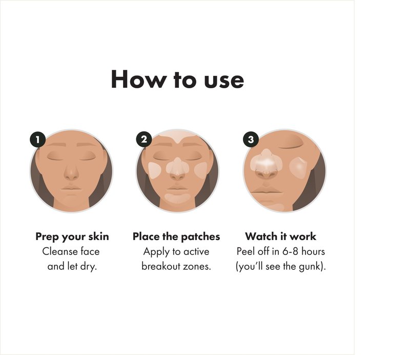 Mighty Patch Hero Cosmetics Face Patch - XL Hydrocolloid Face Mask for Acne, 5 Large Pimple Patches for Zit Breakouts on Nose, Chin, Forehead & Cheeks (1 Count)