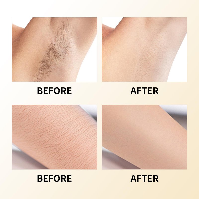 Cyperus Rotundus Oil, Hadea cyperus hair removal oil Natural Hair Removal Solution Reducing Body Hair Growth, Smooth Skin & Moisturizing for All Skin Types