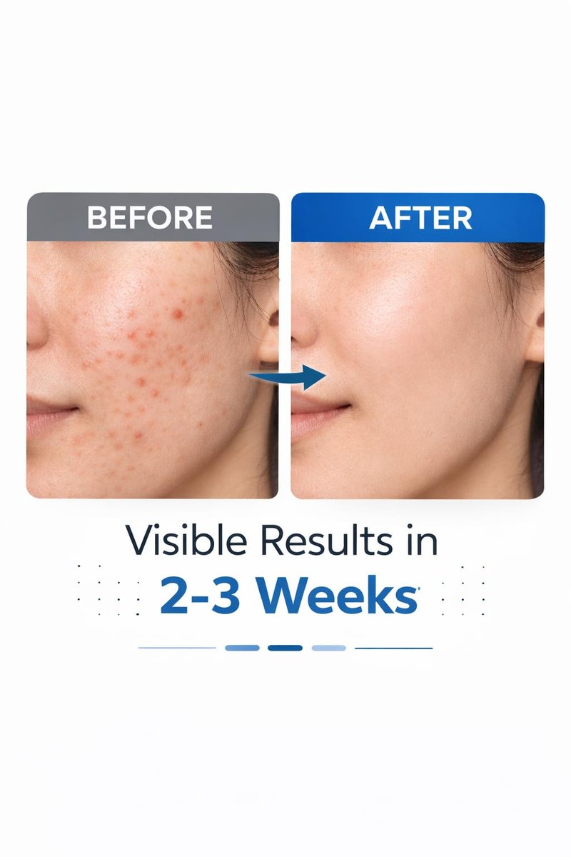 Equal Health Salicylic Acid Acne Face Wash for Oily Skin – Oil Control Deep Pore Cleanser for Pimples, Blackheads & Dark Spots – Acne Treatment Facial Cleanser – 2.7 oz