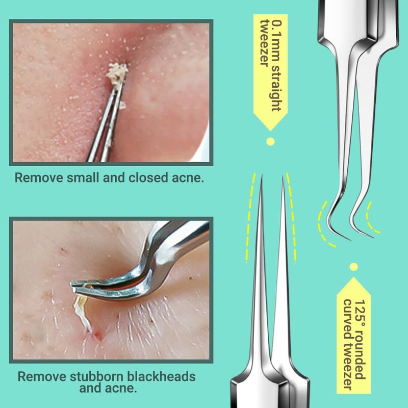 Blackhead Remover Tool Kit - 9 Pcs Pimple Popper Set with Ingrown Hair Tweezers & Pore Extractor | Perfect for Acne Treatment