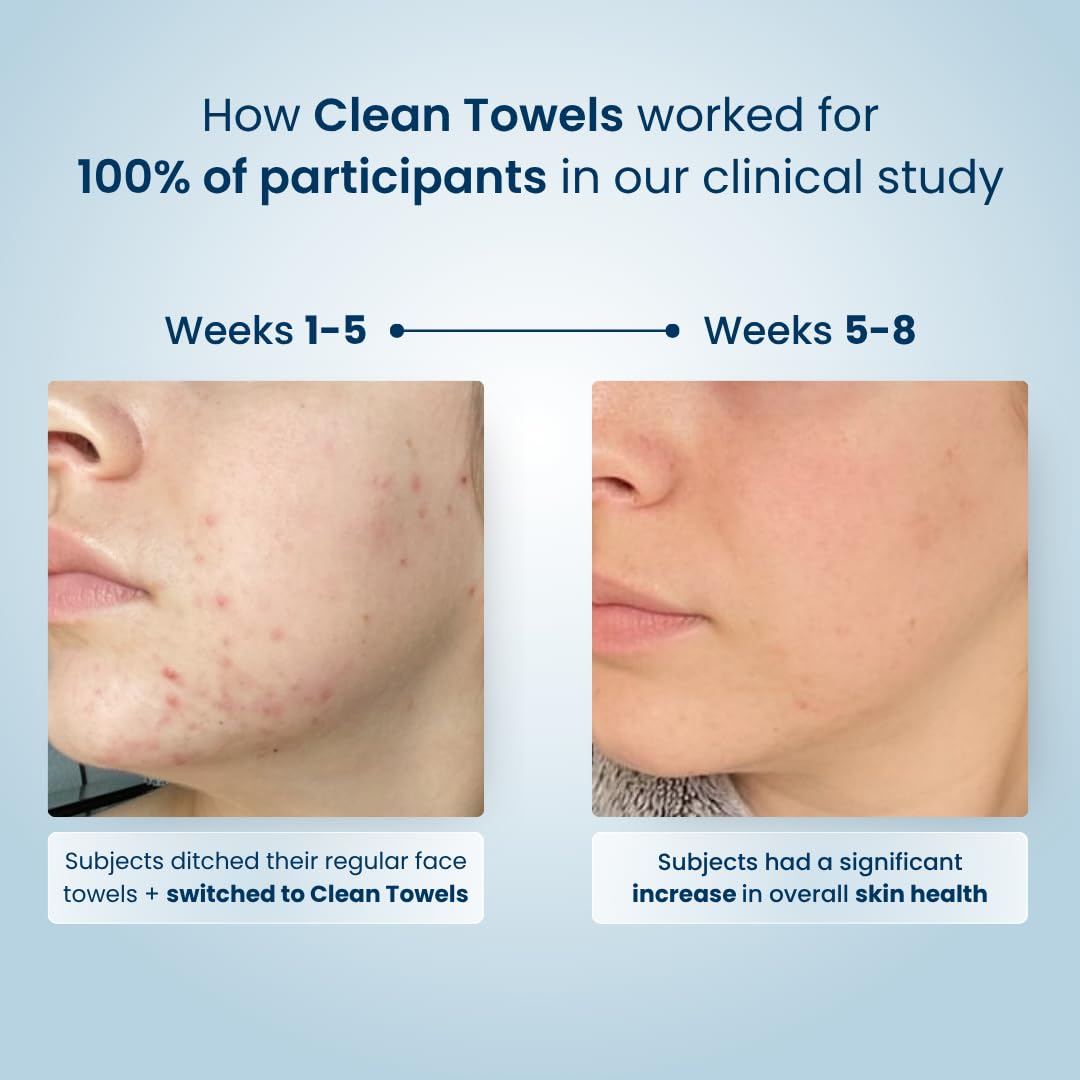 Clean Skin Club Clean Towels®, 100% USDA Biobased Face Towel, Disposable Face Towelette, Eczema Association Accepted, Makeup Remover Dry Wipes, Ultra Soft, 1 Pack, 25 Ct