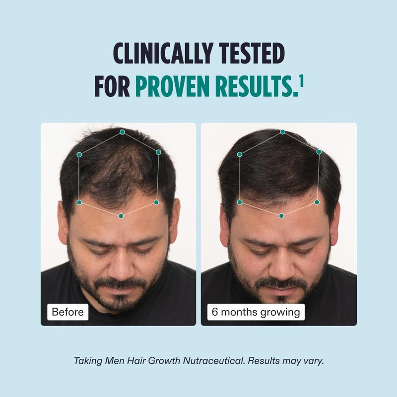 Nutrafol Men's Hair Growth Supplement - Physician-Formulated Collagen Peptides for Thicker Hair | 12 oz Bottle