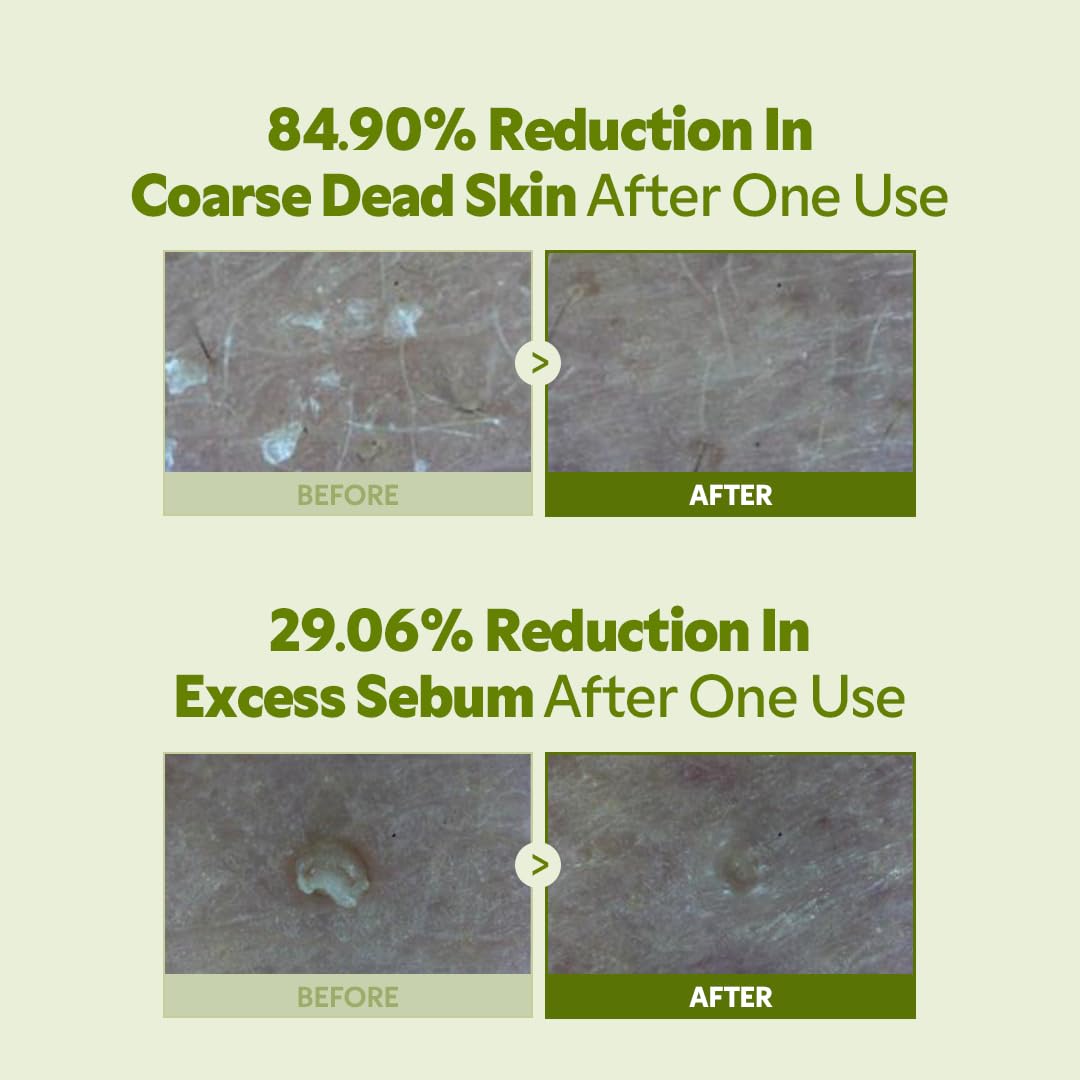 TIRTIR Matcha PDRN Bubble Tea Scrub - Gentle Low-pH Exfoliator with 5,000ppm Vegan Matcha & Ceramide Complex | 100g (3.52oz)