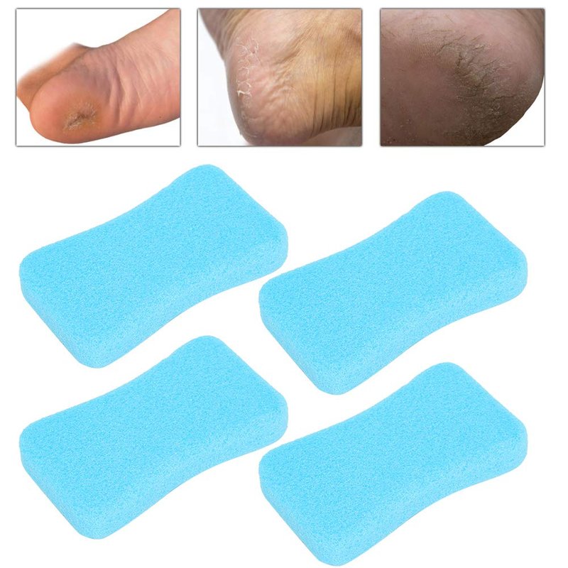 Foot Pumice Stone for Feet Hard Skin Callus Remover and Scrubber, Foot File Exfoliation to Remove Dead Skin (Pack of 4) (Blue)