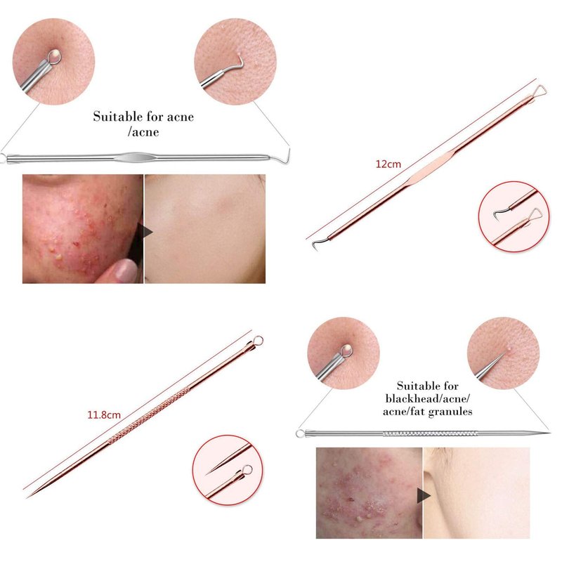 Blackhead Remover Tool - Comedone Extractor Kit for Acne Treatment | Blemish & Whitehead Removal with Case (Rose)