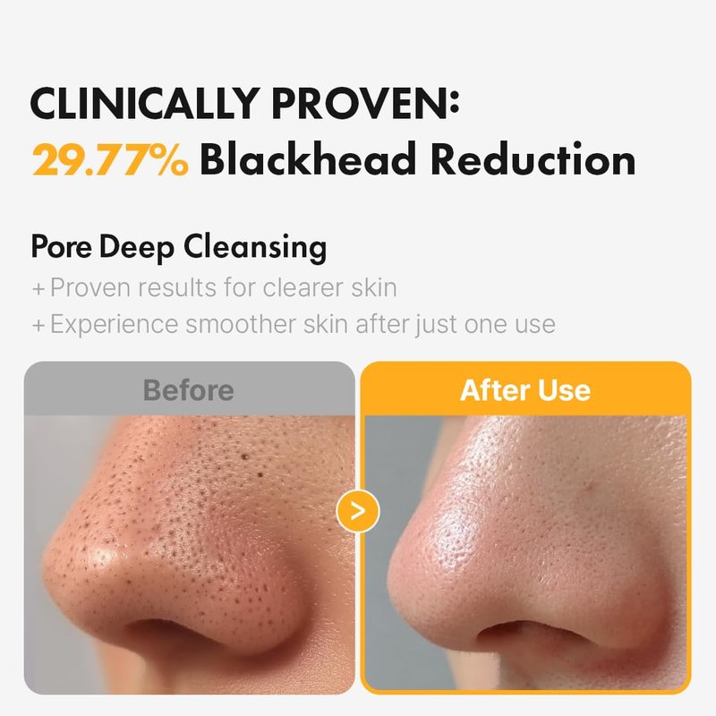 Hanskin PHA Pore Cleansing Oil - Korean Deep Pore Cleansing Makeup & Sebum Remover XL, Blackhead & Large Pores Cleanser for Sensitive Skin, Double Cleansing First Step, Plant-Based Care, 10.14oz
