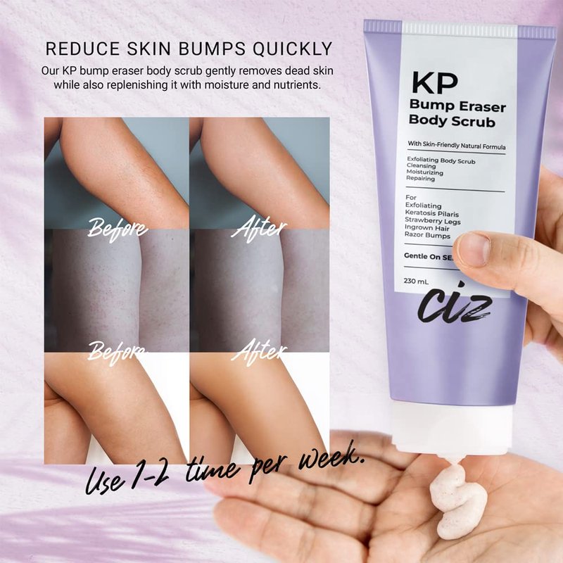 BellamiLuxx KP Bump Eraser Body Scrub: Exfoliating Keratosis Pilaris, Strawberry Skin Treatment - Smooths Rough, Bumpy, Dry Skin on Arms, Legs, Buttocks - KP Scrub Wash Helps Reduce Ingrown Hair Bumps