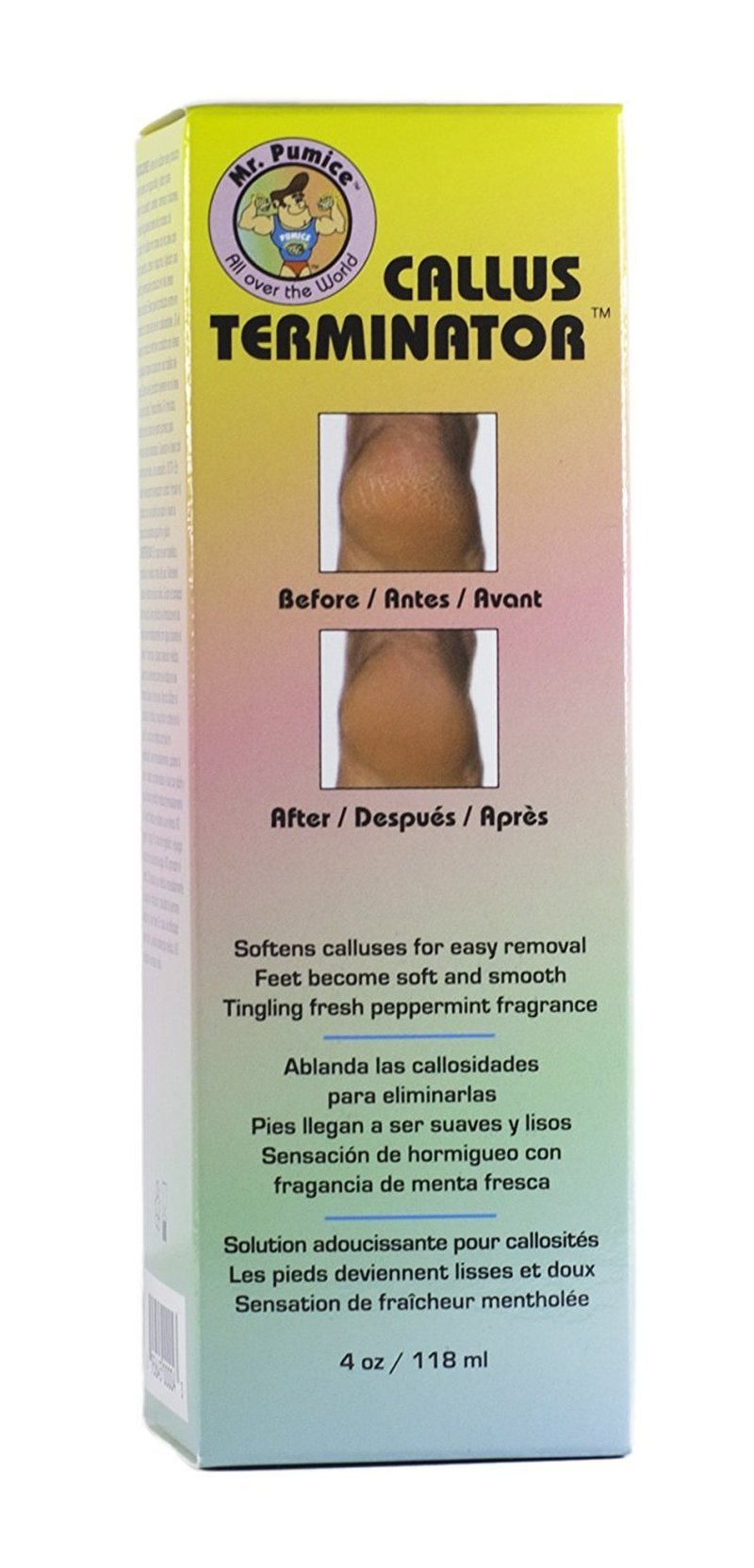 Callus Terminator by Mr. Pumice - 4oz Foot Care Treatment for Smooth Skin